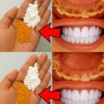 Natural Remedy to Relieve Bone Pain and Support Mental Well-Being