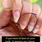 Turmeric, Ginger & More: The Simple Daily Ritual That Could Transform Your Wellness